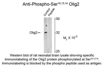 Western Blot: OLIG2 [p Ser14, p Ser10, p Ser13] Antibody [NBP2-29523] - Western blot of rat neonatal brain lysate showing specific immunolabeling of the ~ 32k form of the Olig2 protein phosphorylated at Ser10,13,14. Immunolabeling is blocked by the phospho-peptide used as antigen (peptide), but not by the corresponding dephospho-peptide (not shown).